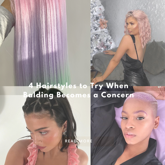 4 Hairstyles to Try When Balding Becomes a Concern