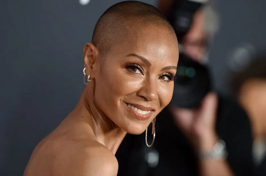 jada-pinkett-hair-loss-alopecia-blog-post